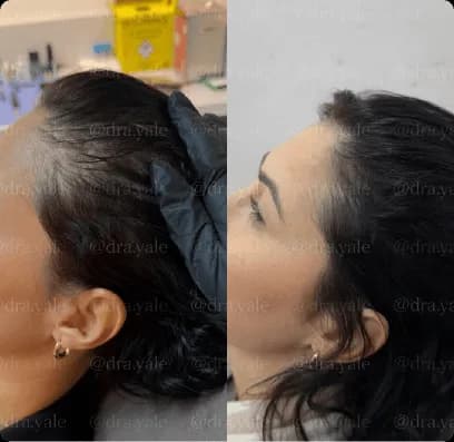 Caso clínico — antes e depois