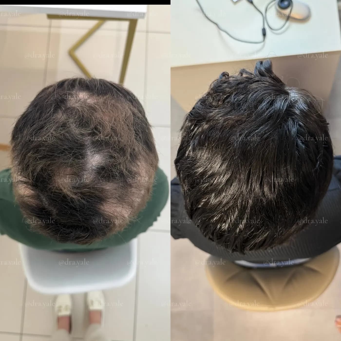 Caso clínico — antes e depois