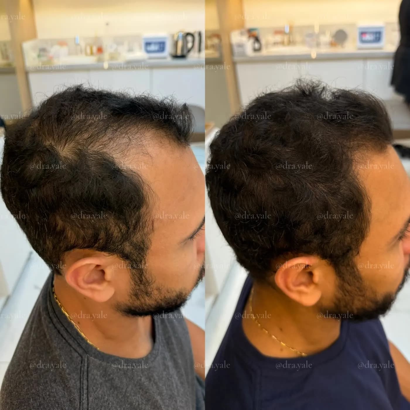 Caso clínico — antes e depois