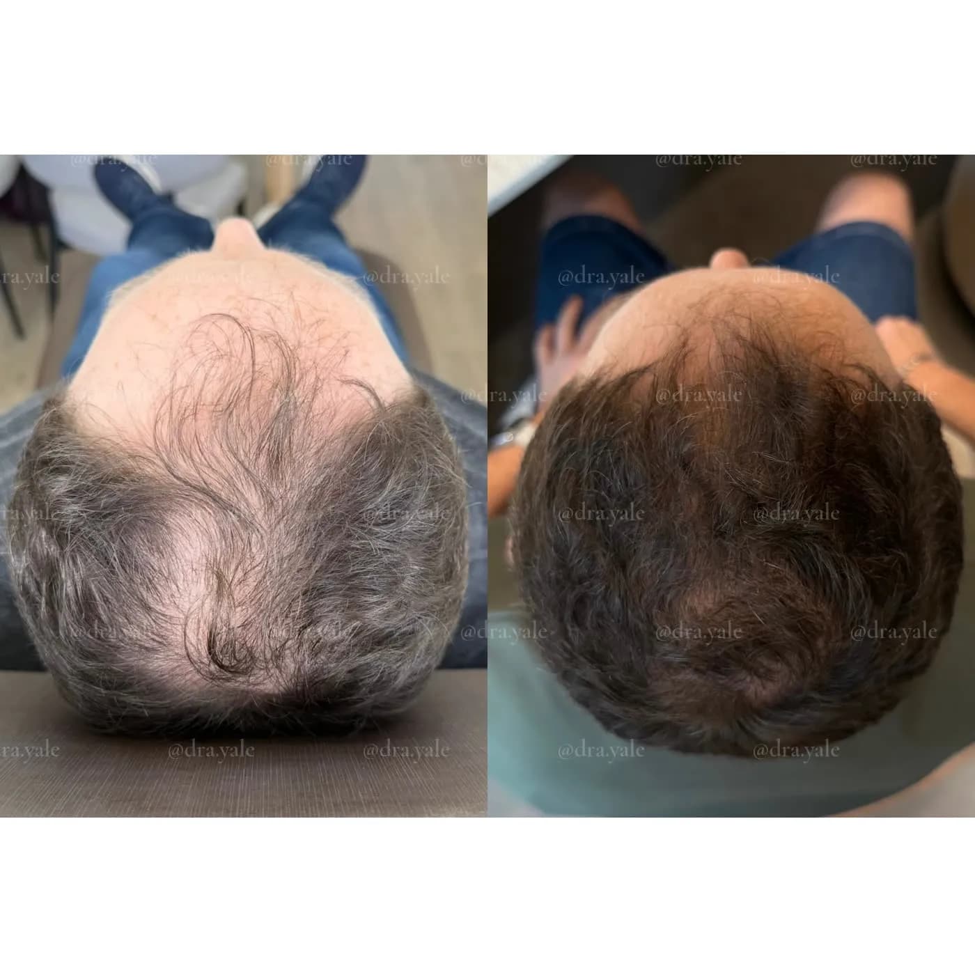 Caso clínico — antes e depois