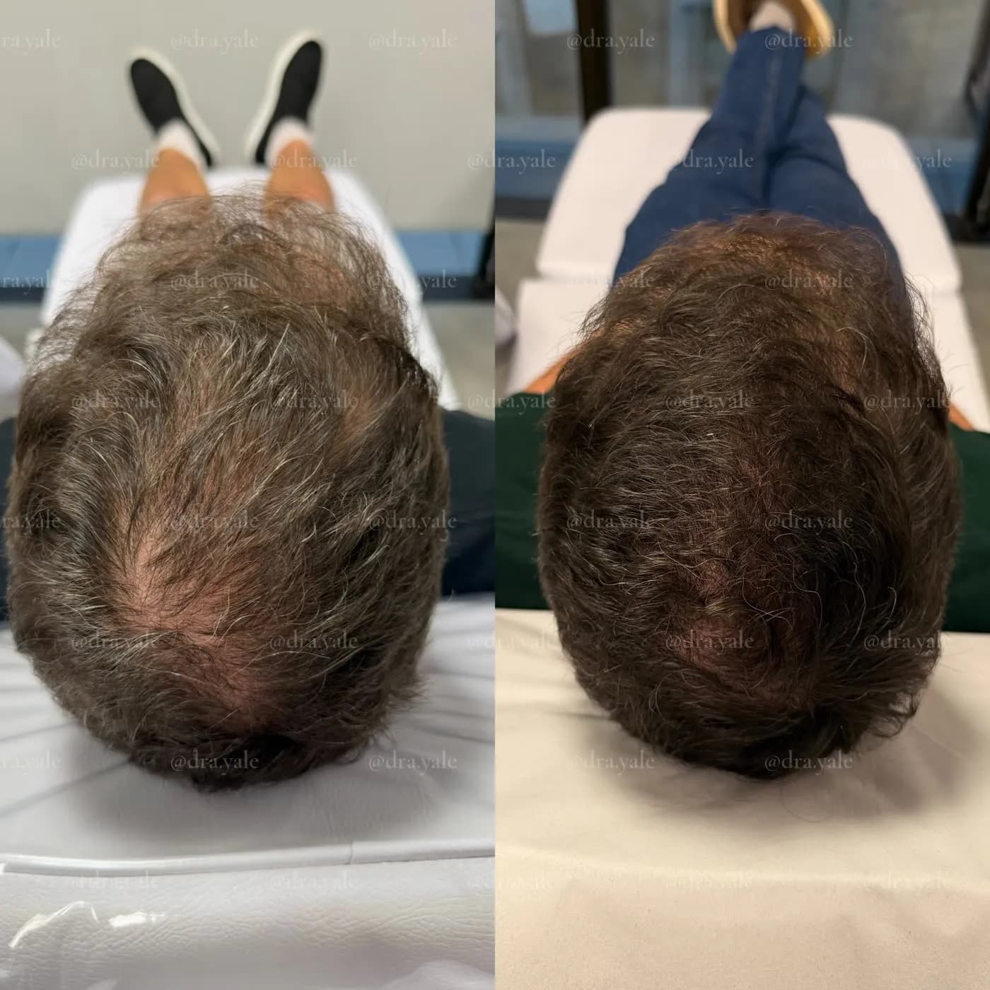 Caso clínico — antes e depois