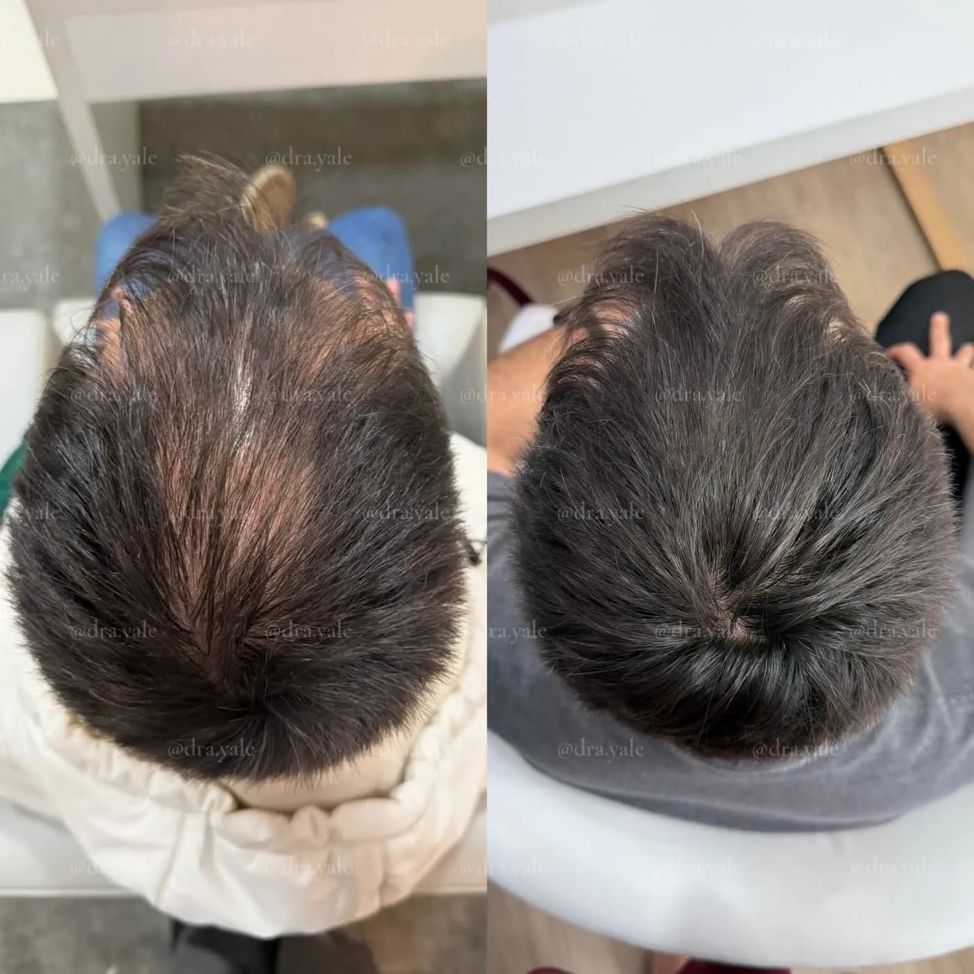 Caso clínico — antes e depois