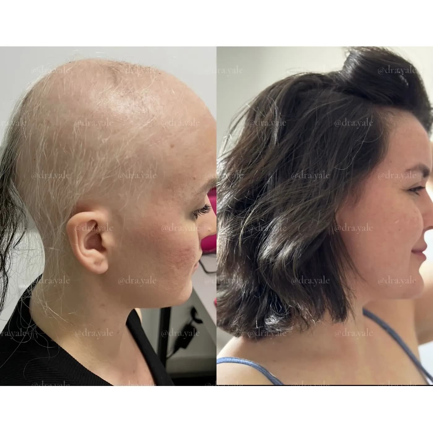 Caso clínico — antes e depois
