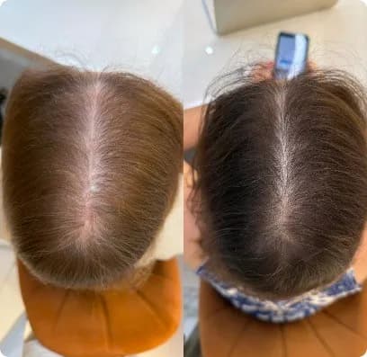 Caso clínico — antes e depois